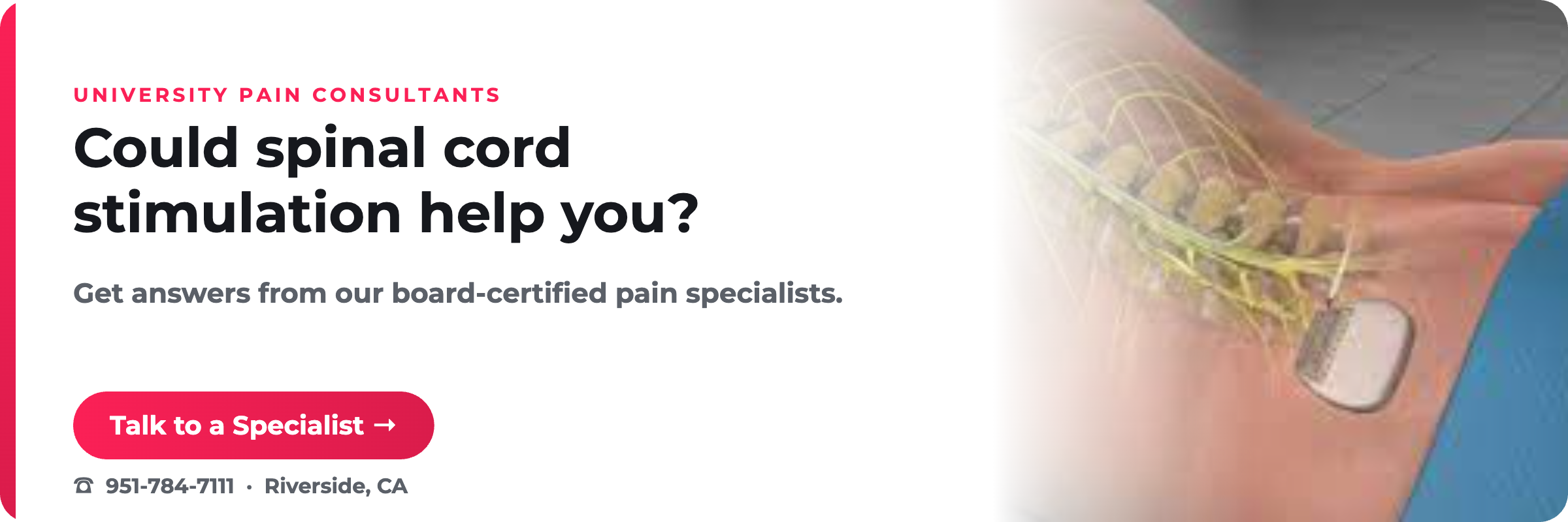 Could spinal cord stimulation help you? University Pain Consultants, Riverside CA.