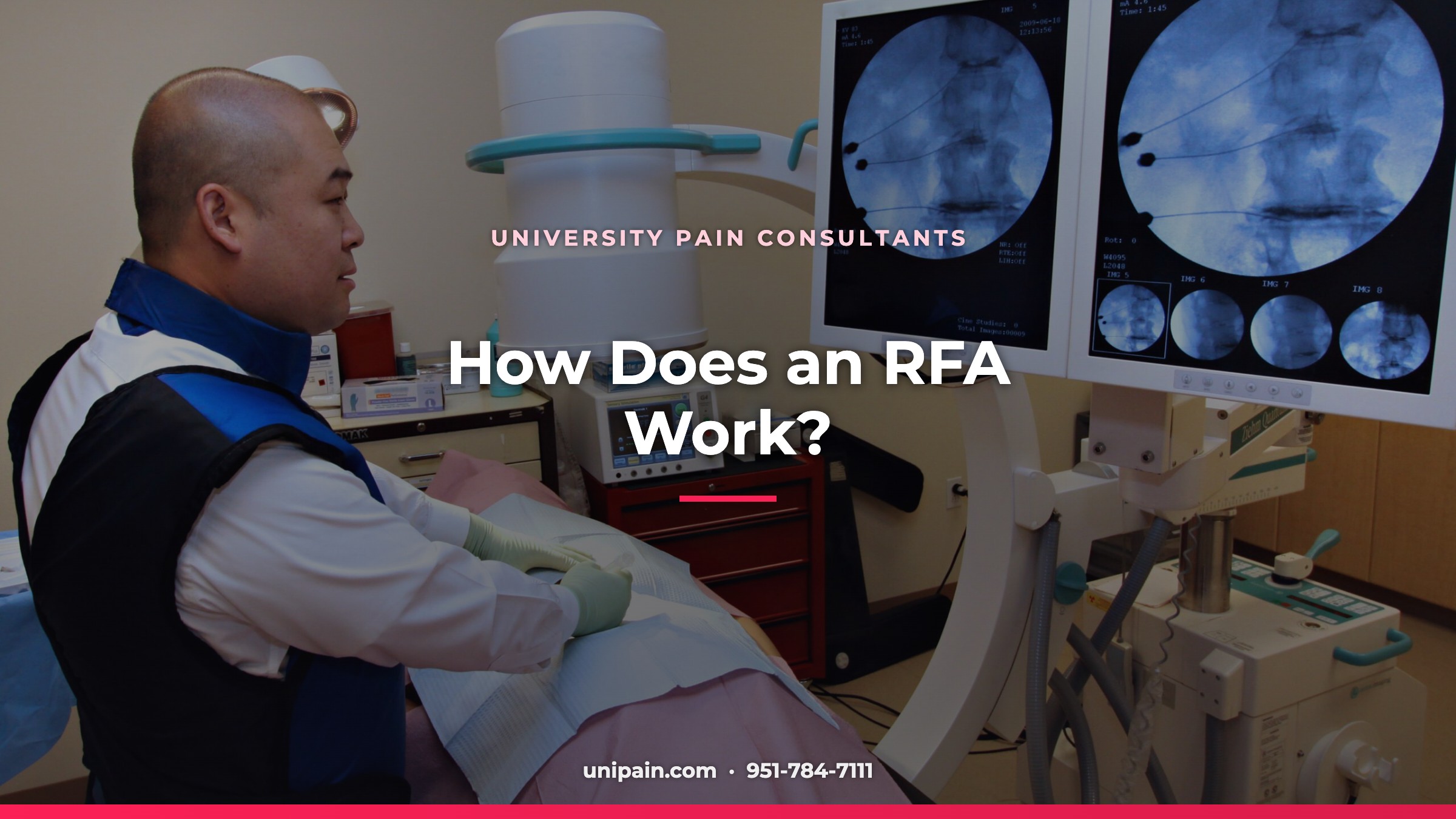 How does an RFA work?