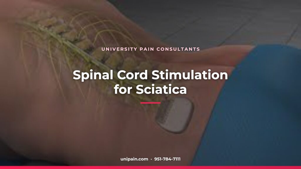 Spinal Cord Stimulation for Sciatica — University Pain Consultants, Riverside CA