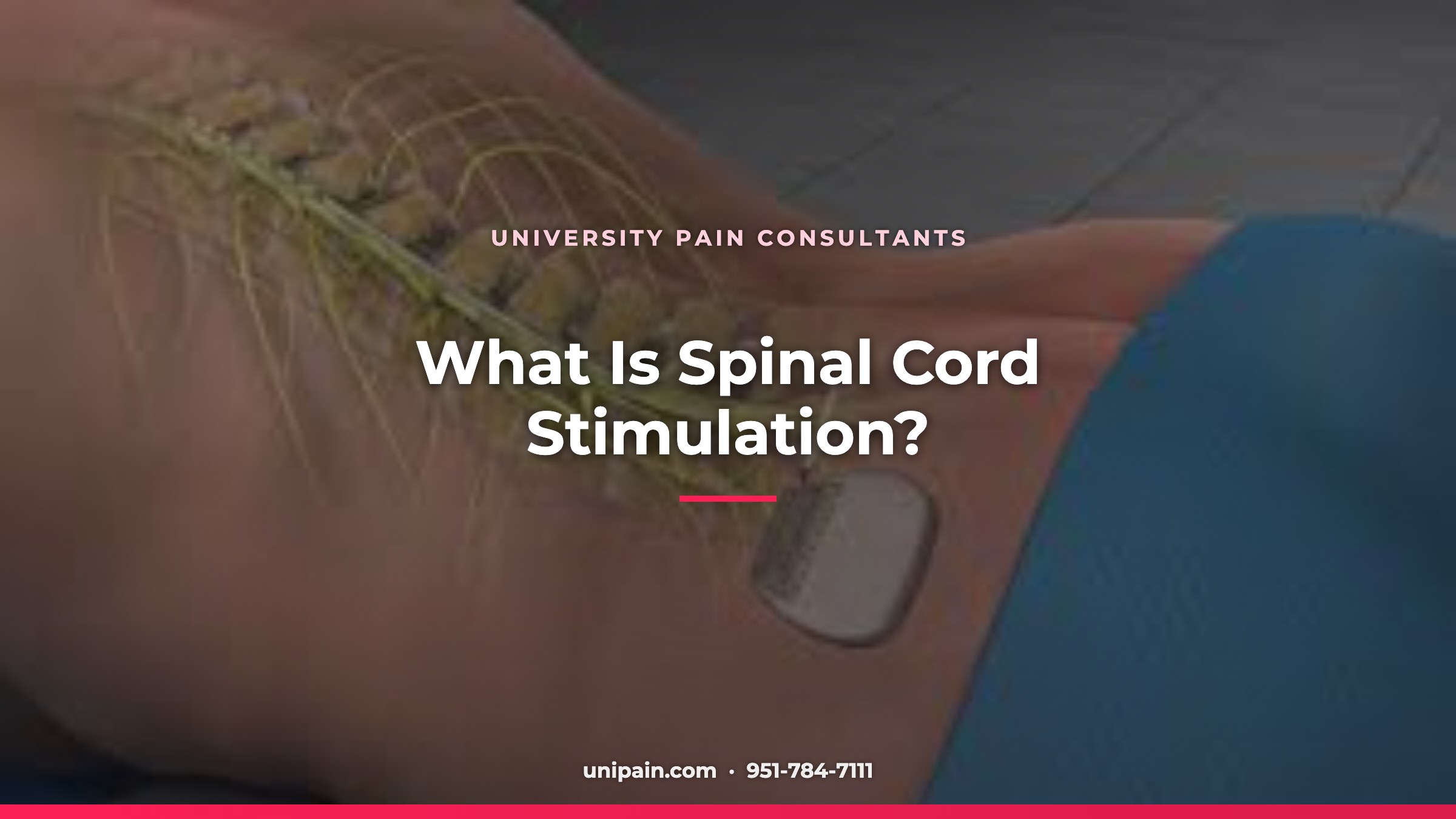 What is Spinal Cord Stimulation?