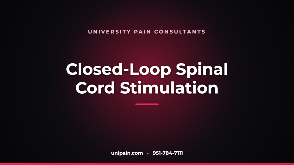 Closed-loop spinal cord stimulation — University Pain Consultants