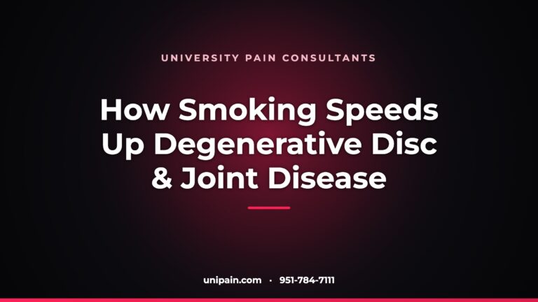 How smoking speeds up degenerative disc and joint disease — University Pain Consultants